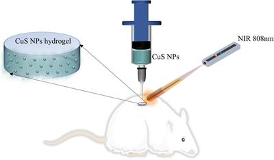 <mark class="highlighted">Copper Sulfide</mark> Nanoparticles-Incorporated Hyaluronic Acid Injectable Hydrogel With Enhanced Angiogenesis to Promote Wound Healing